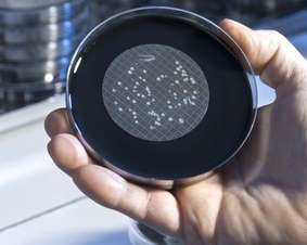Legionellenkultur in einer Petrischale in der Hand eines Wissenschaftlers
